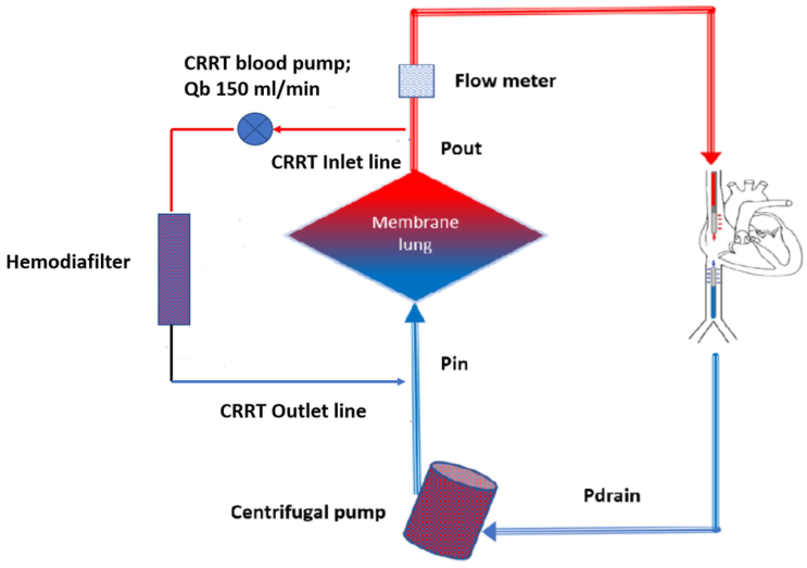 ECMO Combined with CRRT : 네이버 블로그