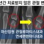 [창원 관절류마티스 연세편한마디내과] 류마티스관절염의 관절 변형