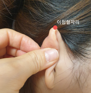 눈다래끼에 좋은 혈자리, 사혈요법 : 네이버 블로그
