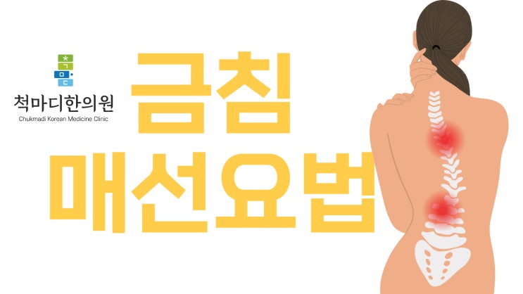 통증에 효과적인 금침 매선요법…급여일까 비급여일까? : 네이버 블로그
