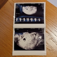 임신일기) 임신을 알게된 첫날
