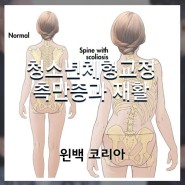 [윈백]청소년 체형교정- 구조적측만증과 기능적측만증 비교!