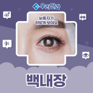 [원주안과] 눈동자가 하얗게 보이는 백내장, 백내장의 증상과 인공수정체의 선택