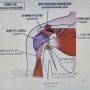 팔을 들어 올리기가 고통스럽다면~어깨 통증, 어깨충돌 증후군