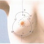 광주가슴축소 수술의 핵심포인트. 전주가슴축소수술