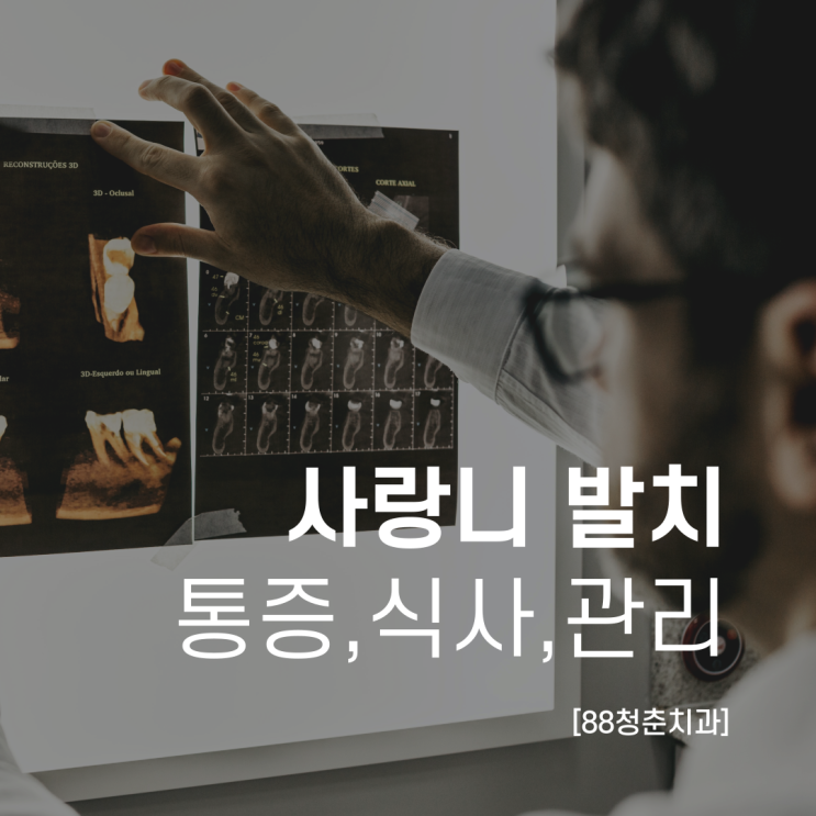 사랑니 발치 통증, 식사, 관리까지 / 두암동 88청춘치과 : 네이버 블로그