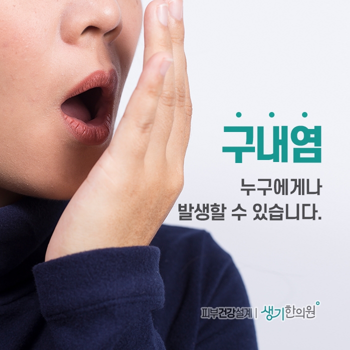 구내염치료 입병 빨리 낫는법 : 네이버 블로그