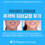 일산치과 - 심하지 않은 주걱턱 수술없이 발치 후 치아교정 무턱/주걱턱 / 일산연치과 교정후기