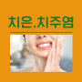 치주 질환 : 치은염 치주염 원인 증상 치과 치료 잇몸 아플때 약 추천 염증 출혈 고름 구취