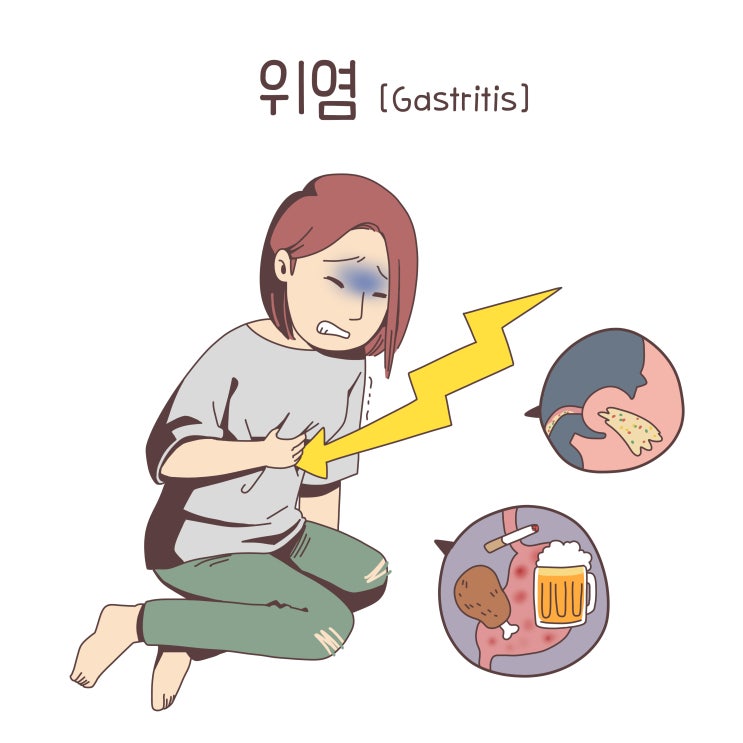 울산위염 - 급성위염 만성위축성위염 A형 B형 : 네이버 블로그