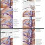 영상유도 조직검사(image guided biopsy)(2)