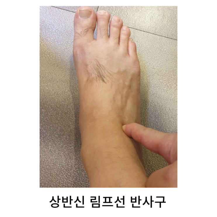 림프선(임파선) 발반사구 : 네이버 블로그