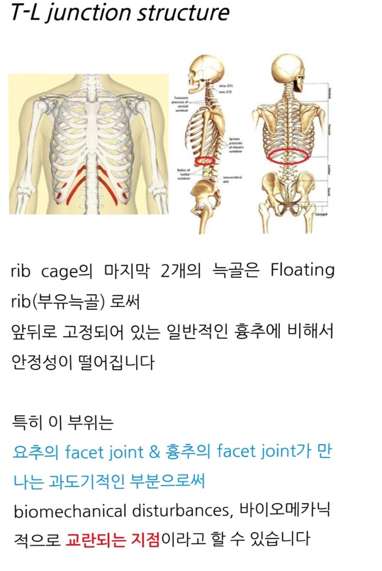 흉요추접합부와 골반통증 관계 : 네이버 블로그