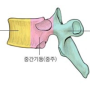 빙판길 넘어짐. 척추압박골절 보상은?