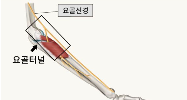 (서울연세21세기의원) 요골 터널 증후군 : 네이버 블로그