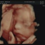 둘째 초음파사진 ,27주임산부 , 검은토끼해 출산
