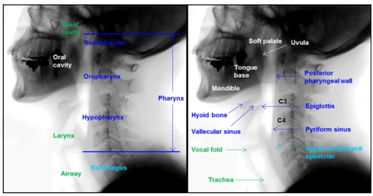 비디오투시연하검사 VFSS (Video-Fluoroscopic Swallowing Study)_1 : 네이버 블로그