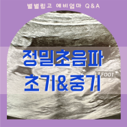 20주 정밀초음파, 초기와 중기 각각 어떤 것을 볼까요?