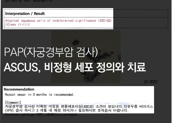 자궁 암 검사 후 ASCUS 진단 비정형 세포 정의, 원인, 치료 : 네이버 블로그