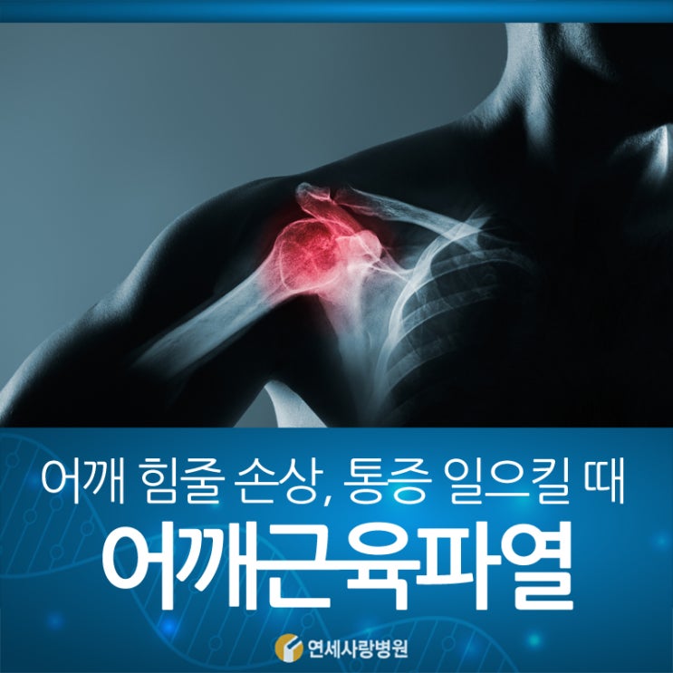 어깨근육파열 치료 전문병원에서는 이렇게 진행됩니다 : 네이버 블로그