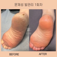 부산 문제성발 관리 잘하는곳 트윈토탈뷰티크