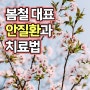 광주백내장 봄철 안질환 예방법과 치료방법