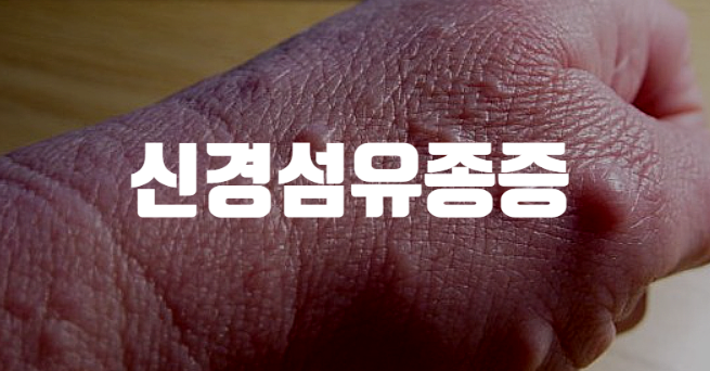 신경섬유종증, 증상과 치료법 정리 : 네이버 블로그