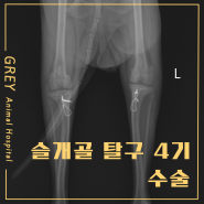 슬개골탈구4기 수술