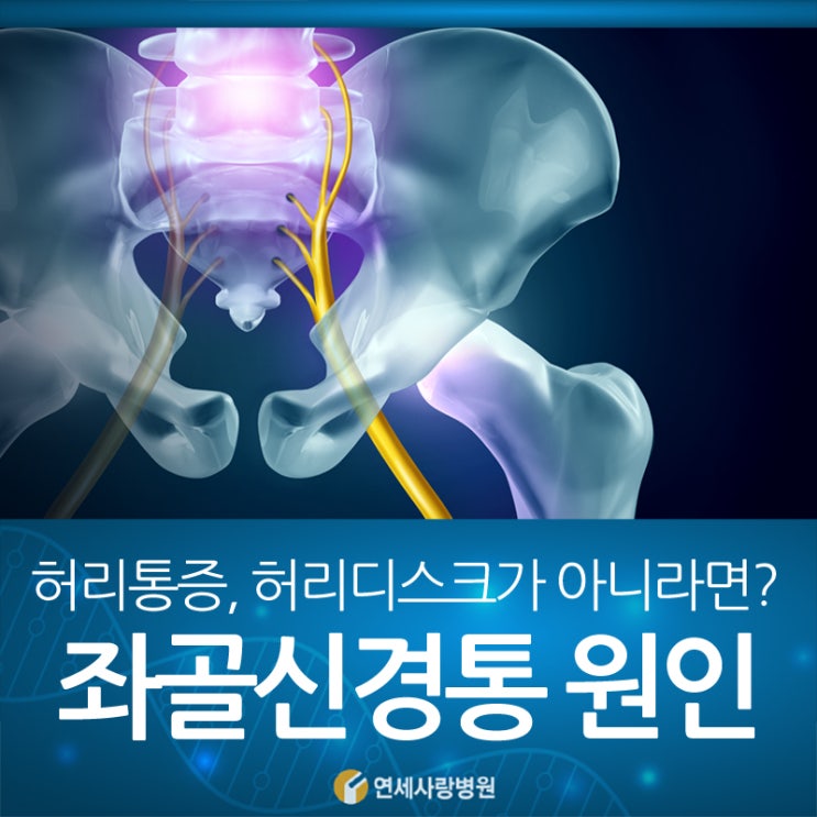좌골신경통 병원에서는 이렇게 치료합니다 : 네이버 블로그