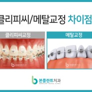 치아교정 클리피씨 vs 메탈, 차이점은?
