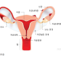 양산 에델여성의원 자궁내막증