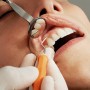 중년의 시기에 접어들었다면 주의가 필요한 치아와 잇몸 증상은?