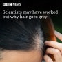 [매일뉴스]BBC News - Reversing hair becoming grey.