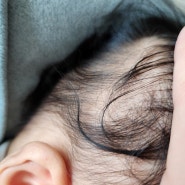 아기머리 비듬각질 지루성피부염 무스텔라 아기샴푸로 극복