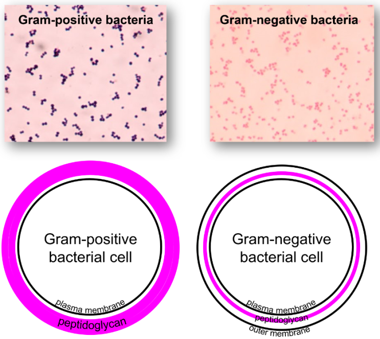 The Processes Involved In Gram Staining : 네이버 블로그