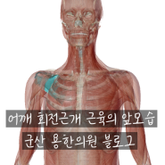 [군산 용한의원] 어깨 회전근개 파열 침치료가 가능할까?