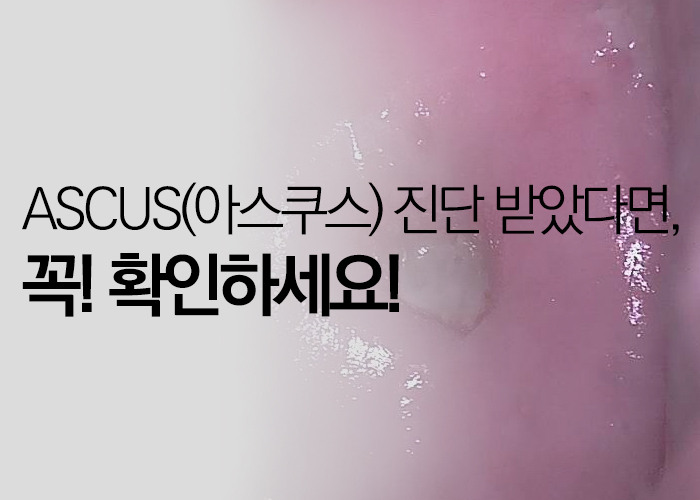 ASCUS(아스쿠스) 진단 받았다면 꼭 확인하세요! (비정형상피세포) : 네이버 블로그