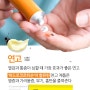 하나 둘씩 서서히 나타나는 모기들! 얘들에게 물리면 어떻게??