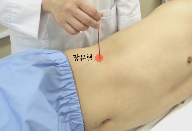 족궐음간경 장문혈 치료효과 반응점 : 네이버 블로그