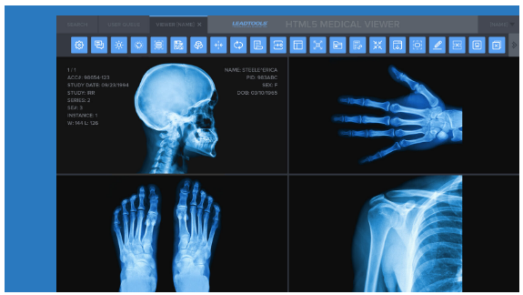 LEADTOOLS Medical Viewer SDK : 네이버 블로그