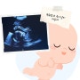 임신 21주차 (태동느끼는시기 정밀초음파 비용)