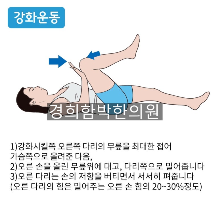 장요근(iliopsoas)은 대요근(posas major) + 장골근(iliacus muscle)입니다. 장요근의 기시 종지 ...