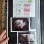 유산 후 재임신/ 나무의 3주-14주차 기록 (젤리곰+성별)