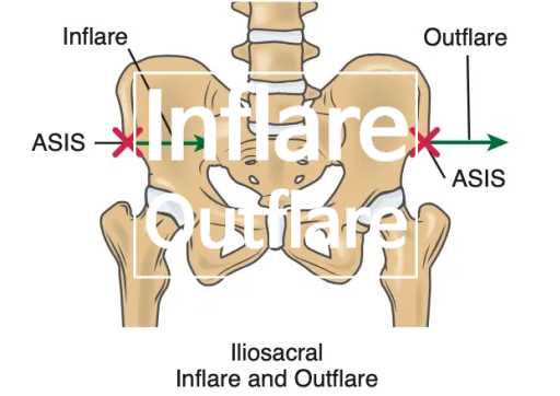 골반교정운동_Inflare, Outflare : 네이버 블로그