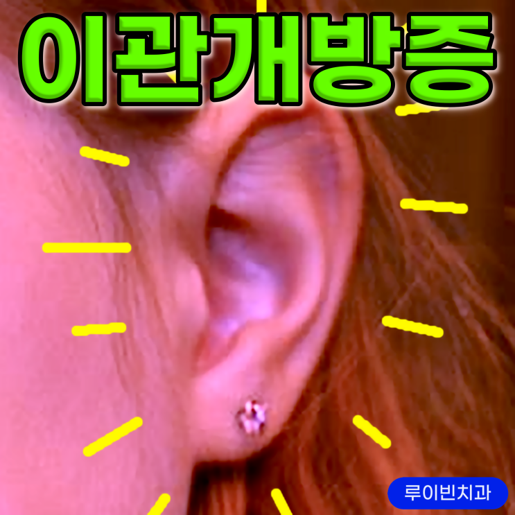 이관개방증, 만성중이염 증상 원인치료 : 네이버 블로그