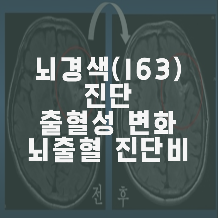 뇌경색(I63)진단과 MRI상 출혈성변화(hemorrhagic transformation), 뇌출혈 진단비 부지급 타당한가 ...