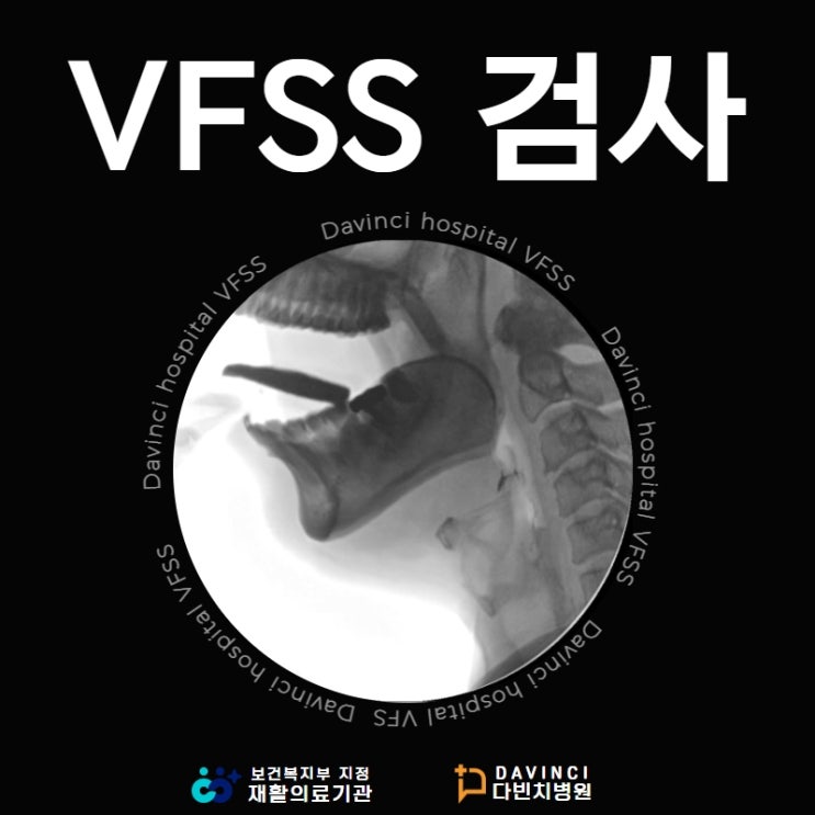 [대전다빈치재활병원] VFSS 검사? 연하검사 란? : 네이버 블로그