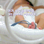 아기 사두증 단두증 신생아두상 교정예방방법