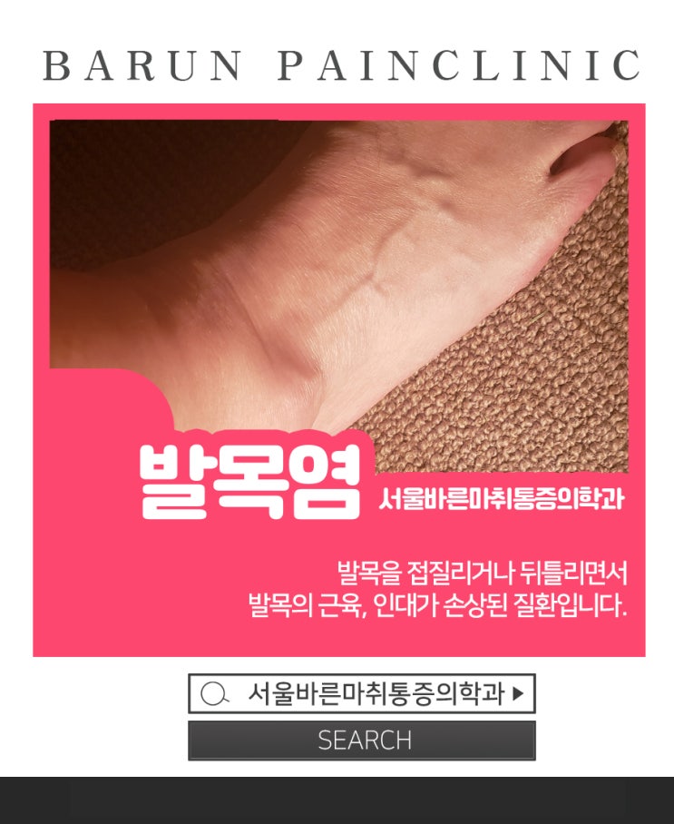 경안동 발목통증 : ‘만성 발목 관절 불안정증’…치료 및 예방법은? : 네이버 블로그