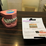 [서울 신촌] 치과 영구치 치아파절 임플란트 없이 하는 치아교정 상담 + 비용 + 시작